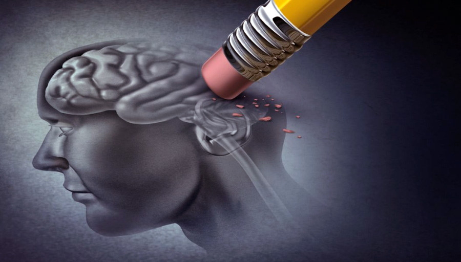 alzheimer հիշողության կորուստ