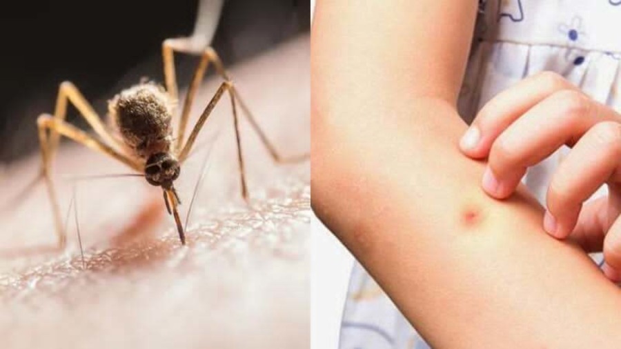 Արևմտյան Նեղոսի տենդ